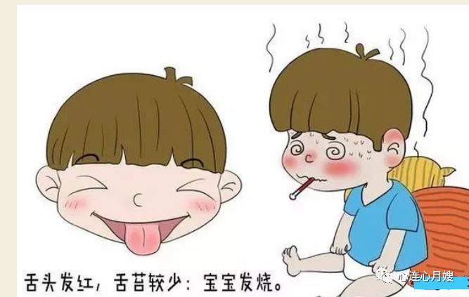 如何看舌头判断孩子身体状况,有图!