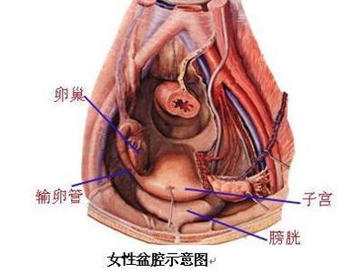 盆腔囊肿是怎么造成的图片