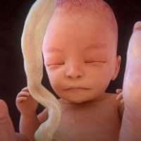 胎儿性别预测