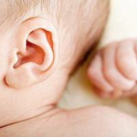 新生儿耳朵畸形