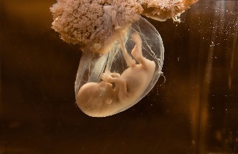 怀孕32周胎儿图片欣赏图片