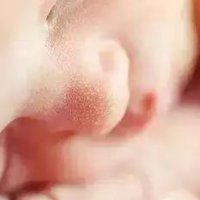 【家家母嬰】10種新生兒皮膚問題，月嫂別慌，正確護理是關鍵